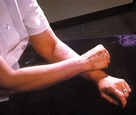 com.bmj.content.model.assessment.Caption@1b5b42a