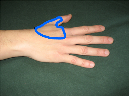com.bmj.content.model.assessment.Caption@3ed4b333