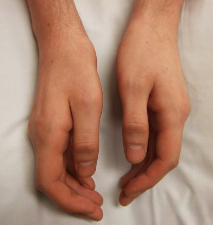 com.bmj.content.model.assessment.Caption@d8a5a3c