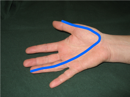 com.bmj.content.model.assessment.Caption@2c22fe46