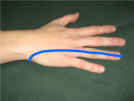 com.bmj.content.model.assessment.Caption@43d14c5c