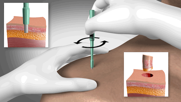 com.bmj.content.model.assessment.Caption@456e5d91