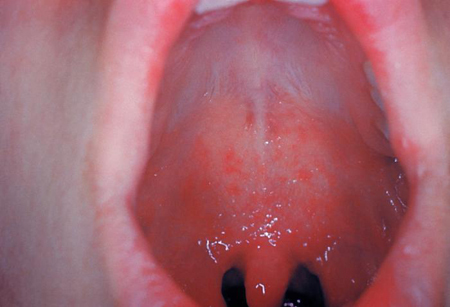 com.bmj.content.model.assessment.Caption@78dcbd42