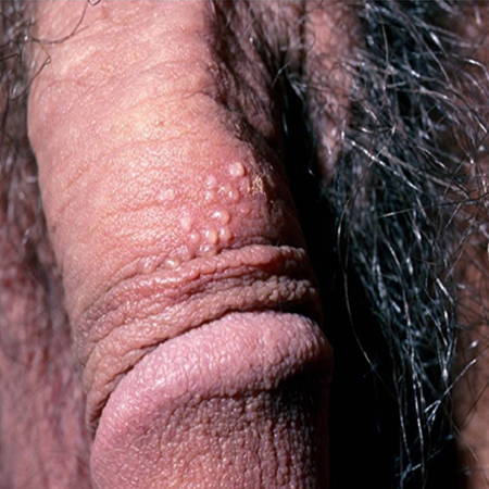 com.bmj.content.model.assessment.Caption@435e2fc8