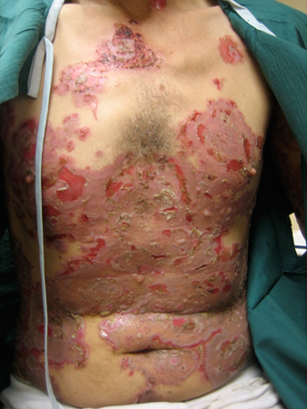 com.bmj.content.model.assessment.Caption@6421829f