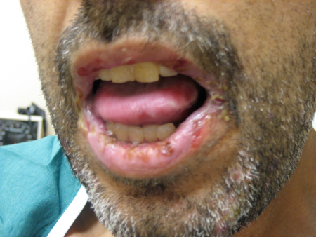 com.bmj.content.model.assessment.Caption@f608c1b