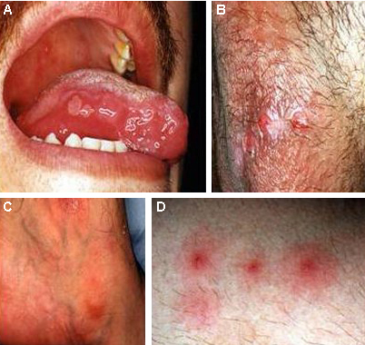 com.bmj.content.model.assessment.Caption@660a936