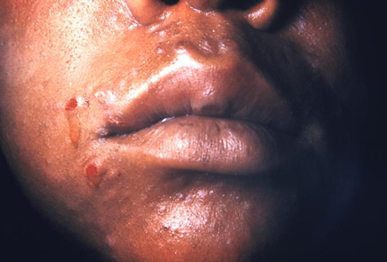 com.bmj.content.model.assessment.Caption@3326823a