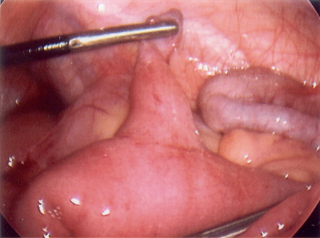 com.bmj.content.model.assessment.Caption@4806b808