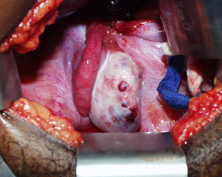 com.bmj.content.model.assessment.Caption@7c4d4893