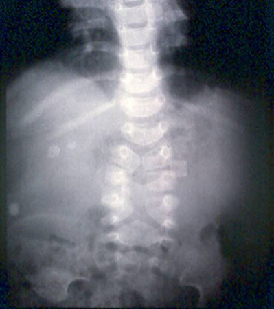 com.bmj.content.model.assessment.Caption@55918c02