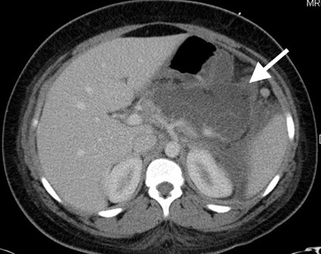 com.bmj.content.model.assessment.Caption@29d86d55