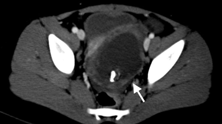 com.bmj.content.model.assessment.Caption@7a9e0118