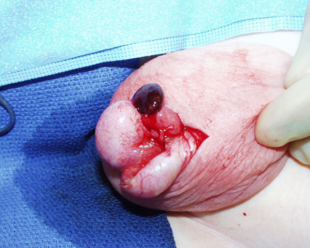 com.bmj.content.model.assessment.Caption@22467cf5