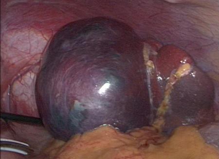 com.bmj.content.model.assessment.Caption@4496d737