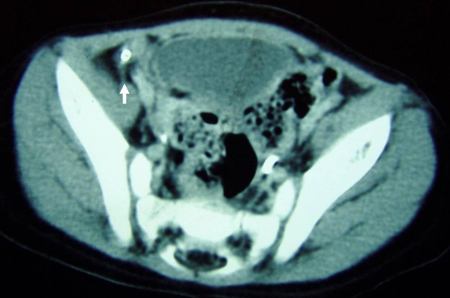 com.bmj.content.model.assessment.Caption@f2942b5