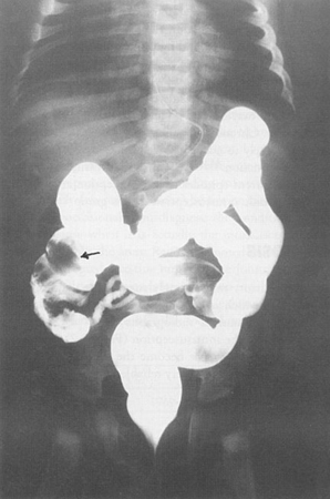 com.bmj.content.model.assessment.Caption@5bb90636