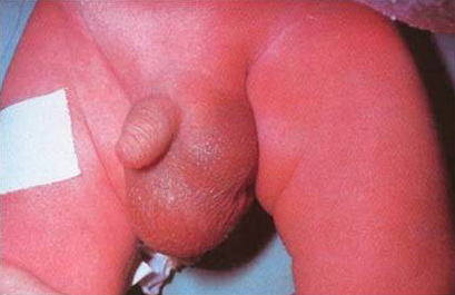 com.bmj.content.model.assessment.Caption@65c248fc