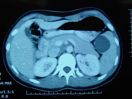 com.bmj.content.model.assessment.Caption@6e66f530