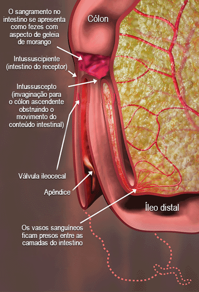 com.bmj.content.model.assessment.Caption@61bc47c4