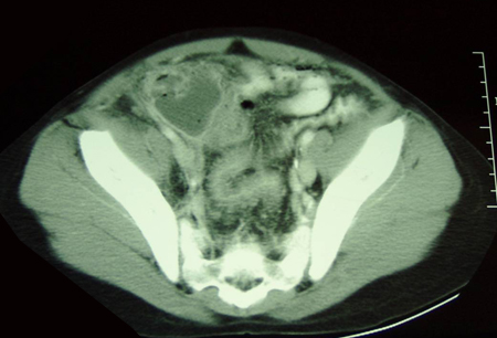 com.bmj.content.model.assessment.Caption@a6e5876