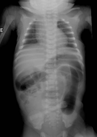com.bmj.content.model.assessment.Caption@30222d97