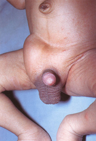 com.bmj.content.model.assessment.Caption@3d639651
