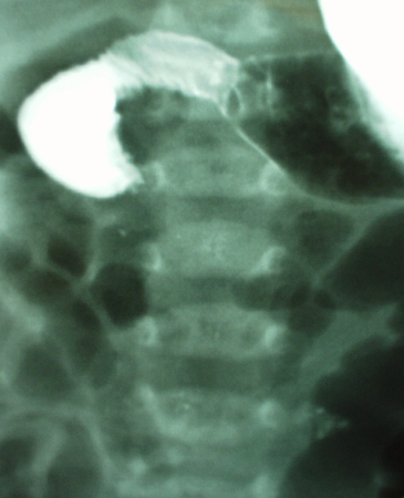 com.bmj.content.model.assessment.Caption@3cd641c4