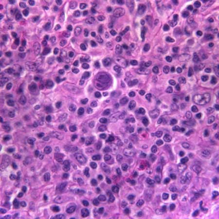 com.bmj.content.model.assessment.Caption@72704307
