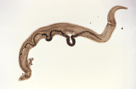 Esquistossomose images