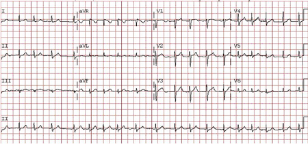 com.bmj.content.model.assessment.Caption@1eb4c453
