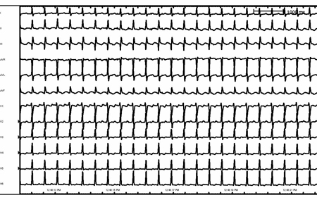 com.bmj.content.model.assessment.Caption@95df7eb