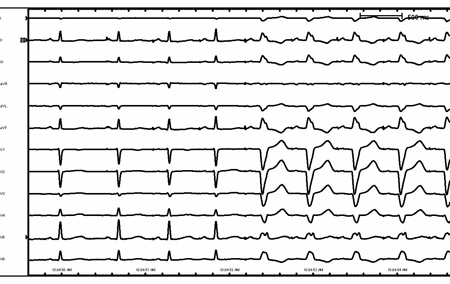 com.bmj.content.model.assessment.Caption@3323e986