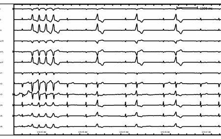 com.bmj.content.model.assessment.Caption@d9d0338