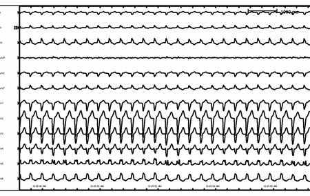 com.bmj.content.model.assessment.Caption@72cbb0a6