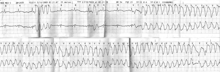 com.bmj.content.model.assessment.Caption@e00b6c6