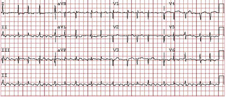 com.bmj.content.model.assessment.Caption@6332ffa5