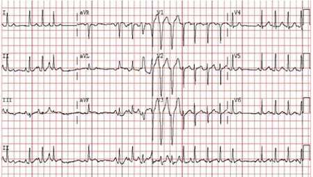 com.bmj.content.model.assessment.Caption@2a969635