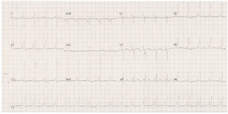 com.bmj.content.model.assessment.Caption@246e6311