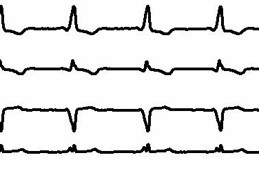 com.bmj.content.model.assessment.Caption@44386a62