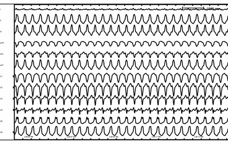 com.bmj.content.model.assessment.Caption@70a0f1c4