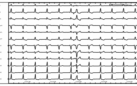 com.bmj.content.model.assessment.Caption@2f0e5c9c