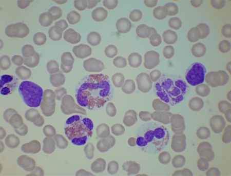 com.bmj.content.model.assessment.Caption@515a8746