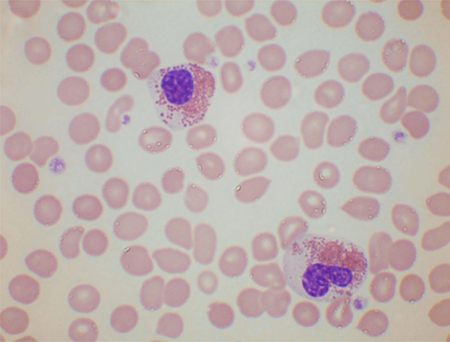 com.bmj.content.model.assessment.Caption@5355aa53