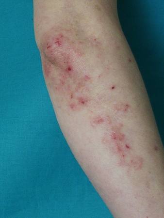 com.bmj.content.model.assessment.Caption@650454be
