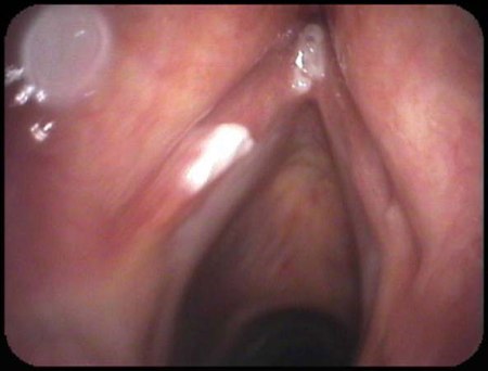 com.bmj.content.model.assessment.Caption@5582f8a6