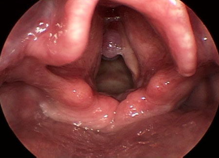 com.bmj.content.model.assessment.Caption@1ca3041c