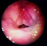com.bmj.content.model.assessment.Caption@5cb668f9