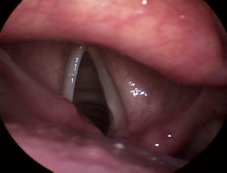com.bmj.content.model.assessment.Caption@7e5f3c3