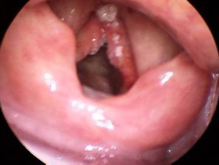 com.bmj.content.model.assessment.Caption@5fb1e9ec